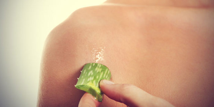 ecolife aloe vera, aloë is goed tegen door zon verbrandde huid